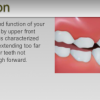 Common Dental Problems | Gamache Orthodontics